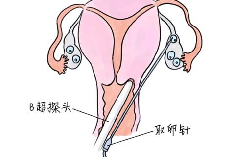 http://foshan.vdtfzz.com/post/205.html|佛山供卵助孕